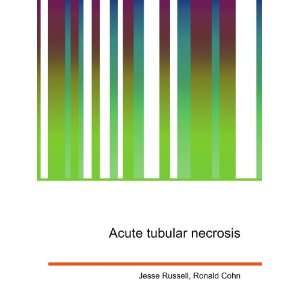  Acute tubular necrosis Ronald Cohn Jesse Russell Books