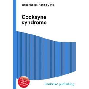  Cockayne syndrome Ronald Cohn Jesse Russell Books