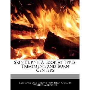  Skin Burns A Look at Types, Treatment, and Burn Centers 